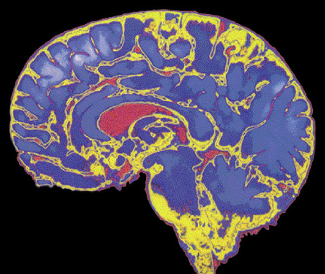 imagem cerebro.PNG