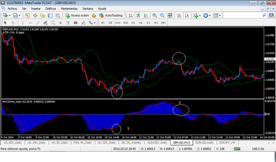Right shoulder divergence.png
